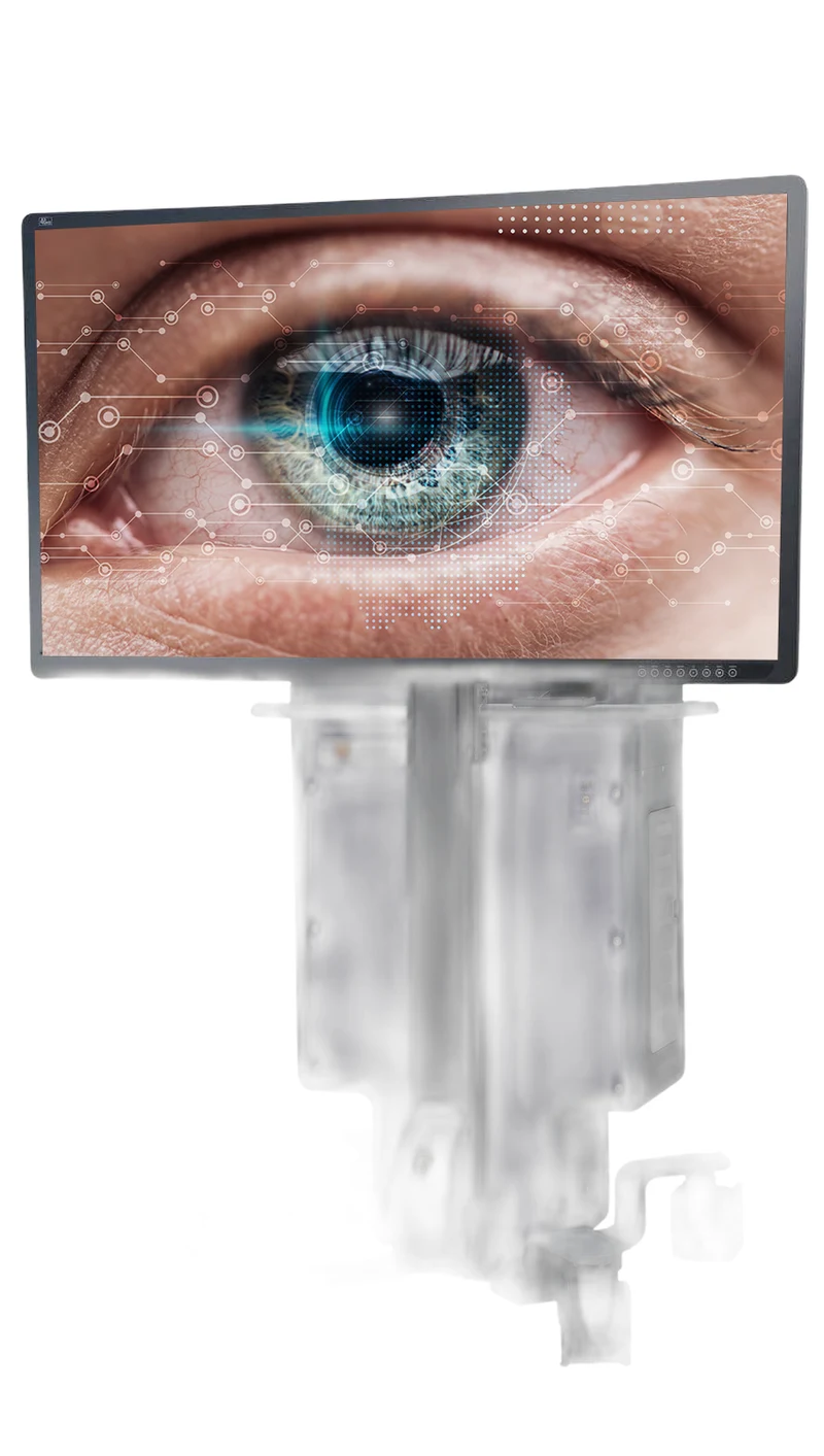 NGENUITY 3D Visualization System Alcon — Sistema de visualização digital usado como apoio à cirurgia ocular