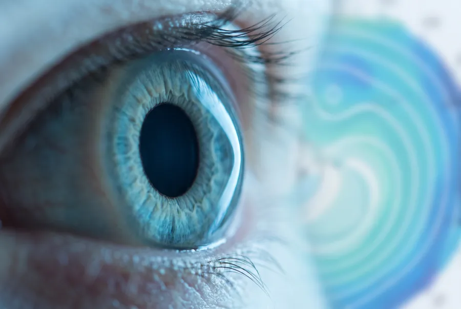 Cirurgia de ceratocone com representação da córnea em destaque — Visare Hospital de Olhos
