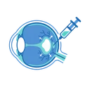 Ilustração de Edema Macular Diabético