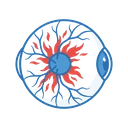Ilustração de Oclusão de Veias da Retina
