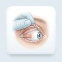 Ilustração de Plástica Ocular