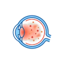Ilustração de Uveítes e Infecções Oculares
