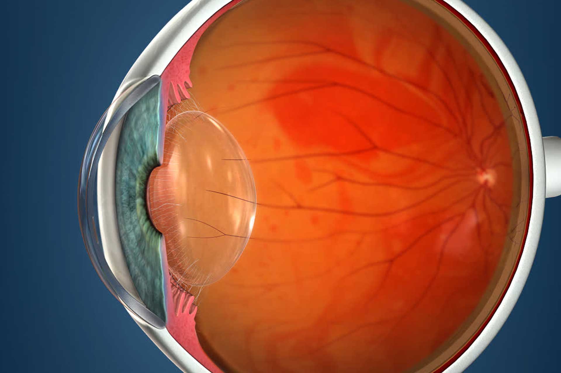 Retina e Vitreo - Clínica de Olhos Nações