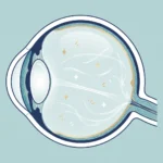 Flashes e moscas volantes podem indicar descolamento de retina?